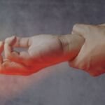 De Quervain’s Tenosynovitis: Movement Integration with Winback TECAR