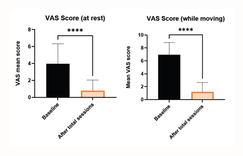 Bar chart showing medication intake before and after TECAR Therapy, with the number of patients using medication dropping sharply from baseline to after total treatment sessions.